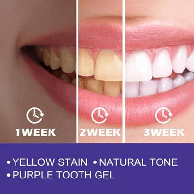 Purple Whitening Toothpaste | معجون الأسنان الأرجواني لتبييض الأسنان